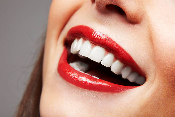 Safe Teeth Whitening Options