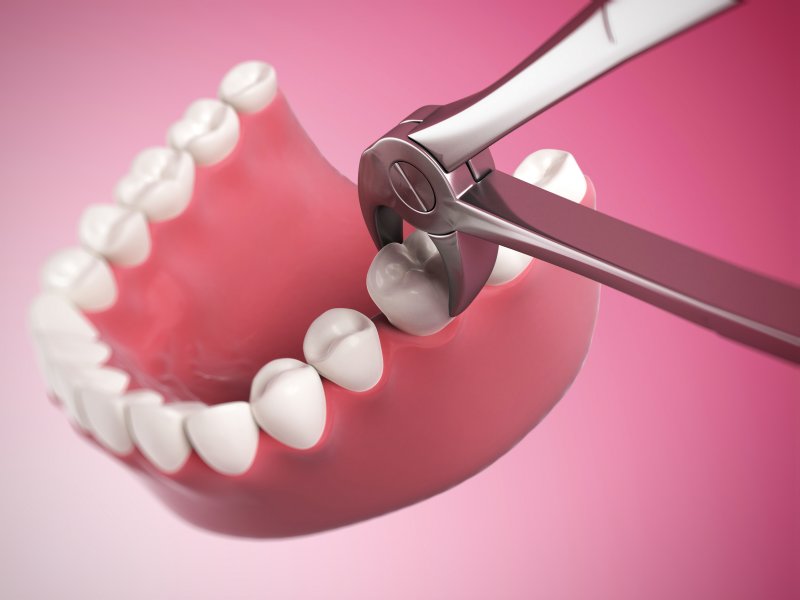 Preventing a Bad Taste After Tooth Extraction