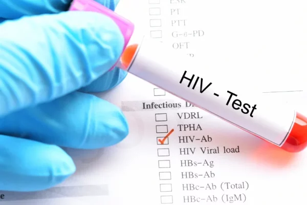 Is a Negative HIV Test at 6 Weeks Definitive