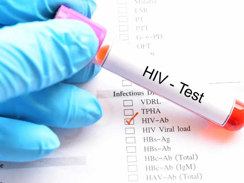 Is a Negative HIV Test at 6 Weeks Definitive