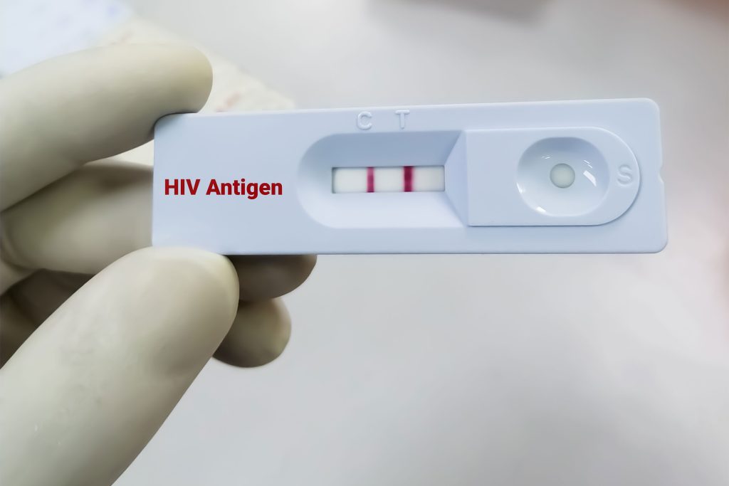 What do false negatives and false positives mean in HIV testing